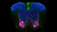 image of ALS-affected neurons in mouse brain